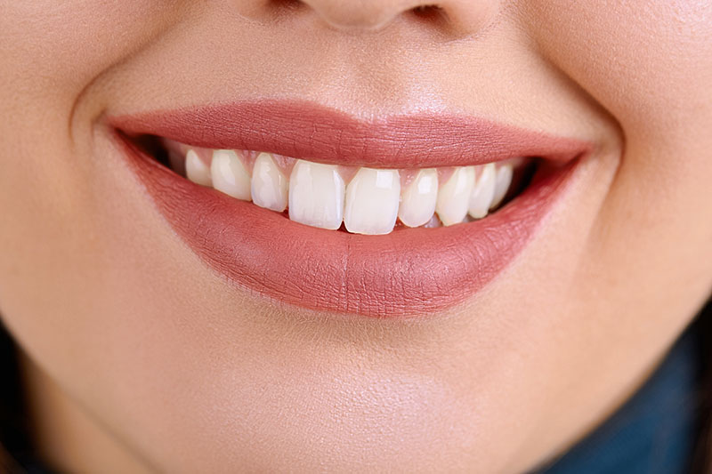 Что такое реставрация зубов?